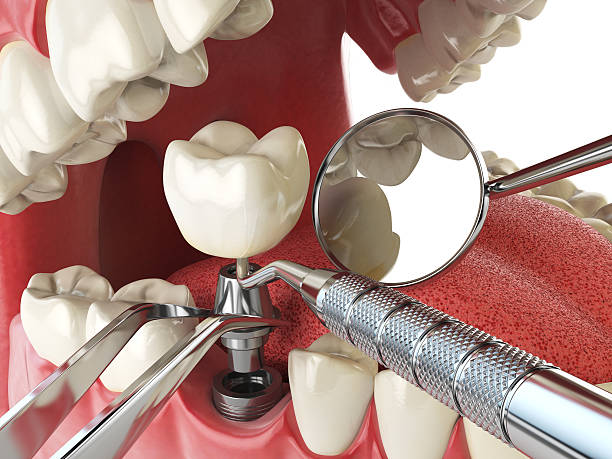 Best Emergency Denture Repair in Fairland, OK
